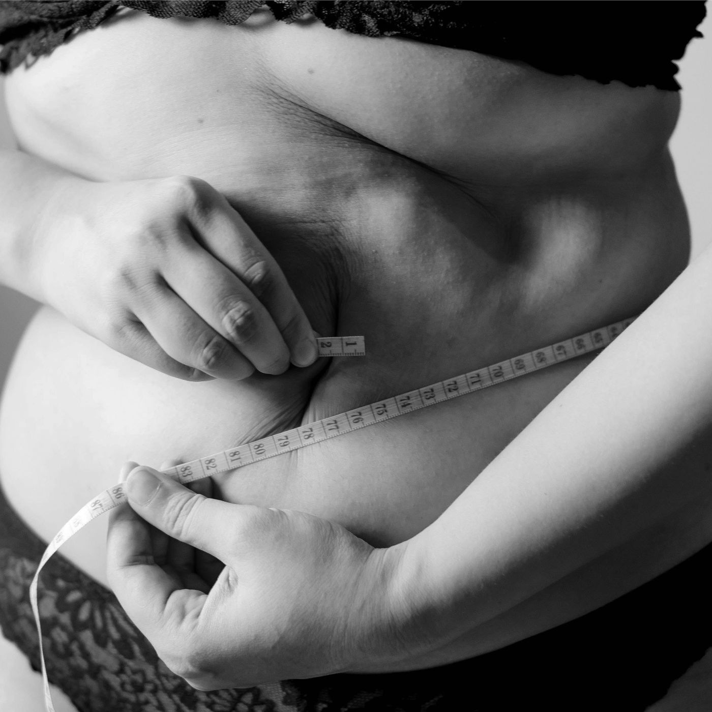 Defeating Visceral Fat: A Guide to Combatting Abdominal Obesity episode artwork