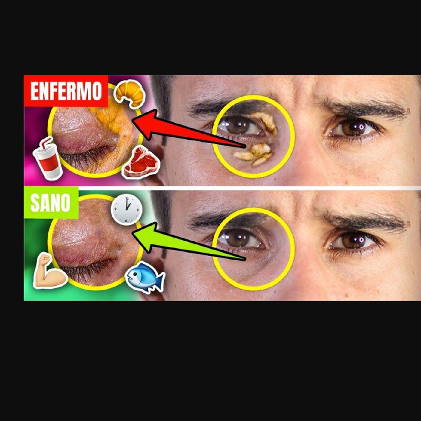 ⚠️PELIGRO de TRIGLICÉRIDOS ALTOS | 15 Formas de BAJAR tus NIVELES *RÁPIDO* 👨‍⚕️SÍNTOMAS CLAVE