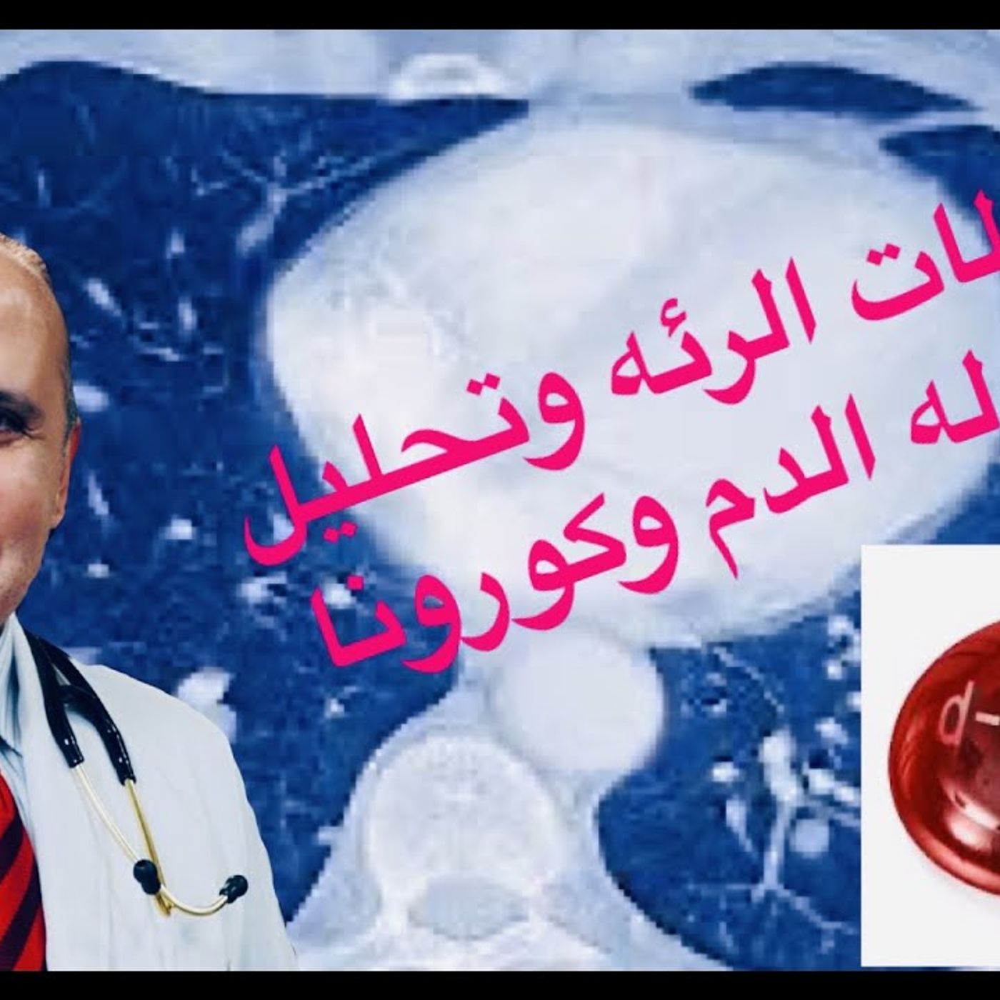 @Khaled_aboelazm ارتفاع حالات الوفيات لمرضي كورونا..جلطه الرئه واهميه تحليل تجلط الدم !! دكتور خالد أبو العزم episode artwork