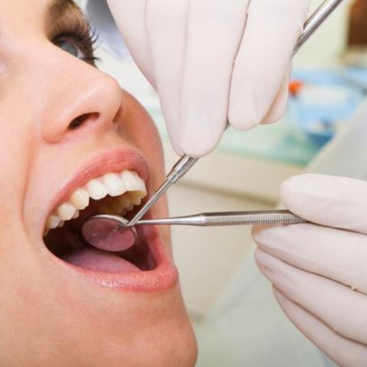 Bright Smiles on a Budget