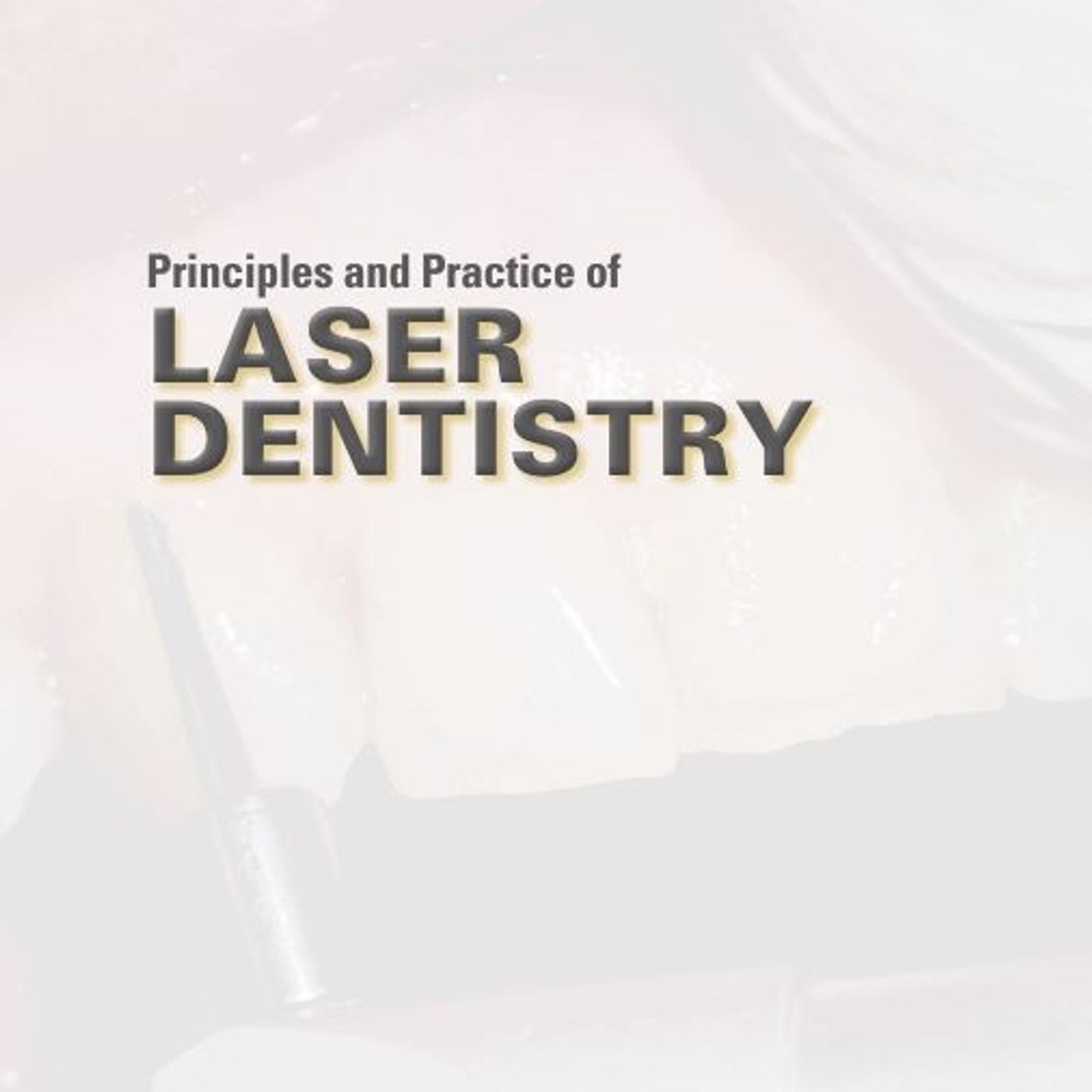 Principles and Practice of Laser Dentistry