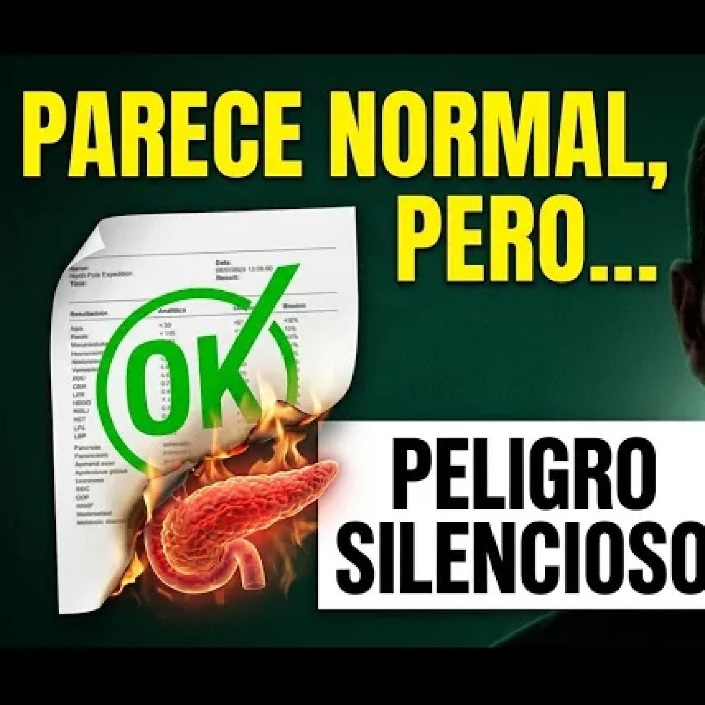 323. Por qué acumulas AZUCAR aunque no comas dulces (y por qué es PELIGROSO)