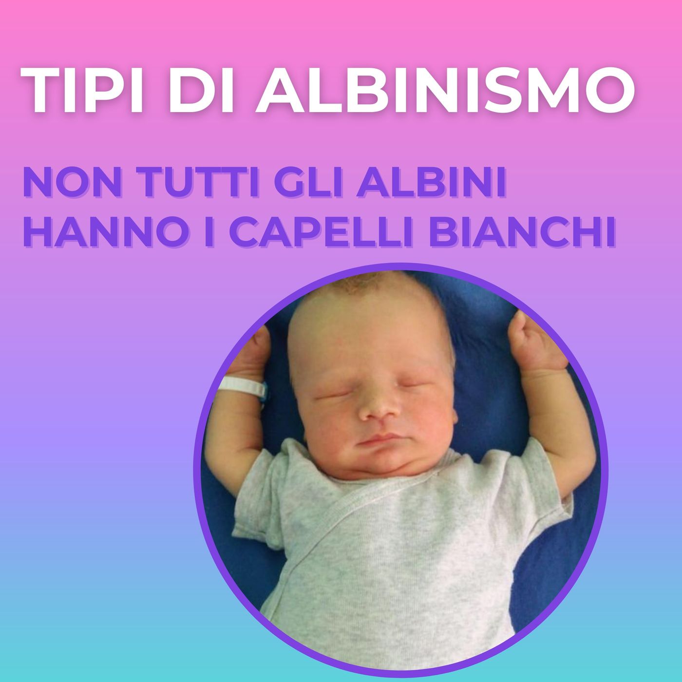 Nero su bianco  - storie di albinismo