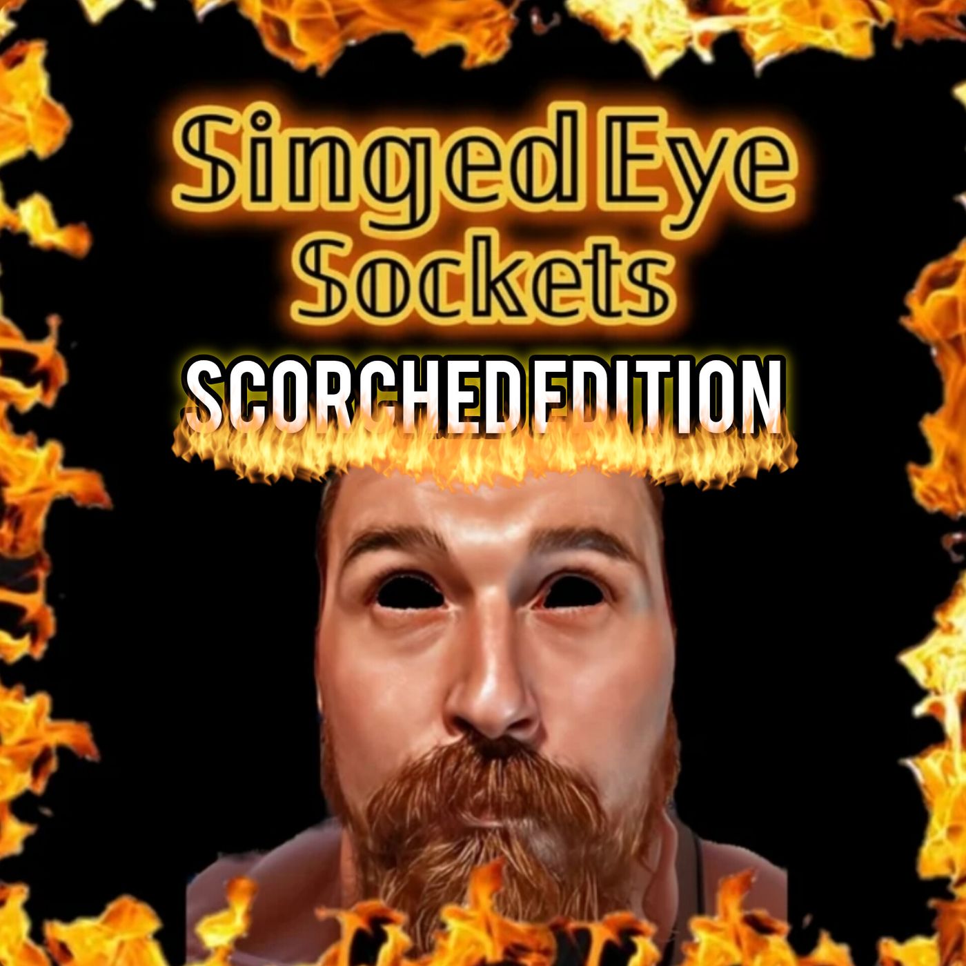 Albert Fish (Scorched edition) feat. Cory Kastle