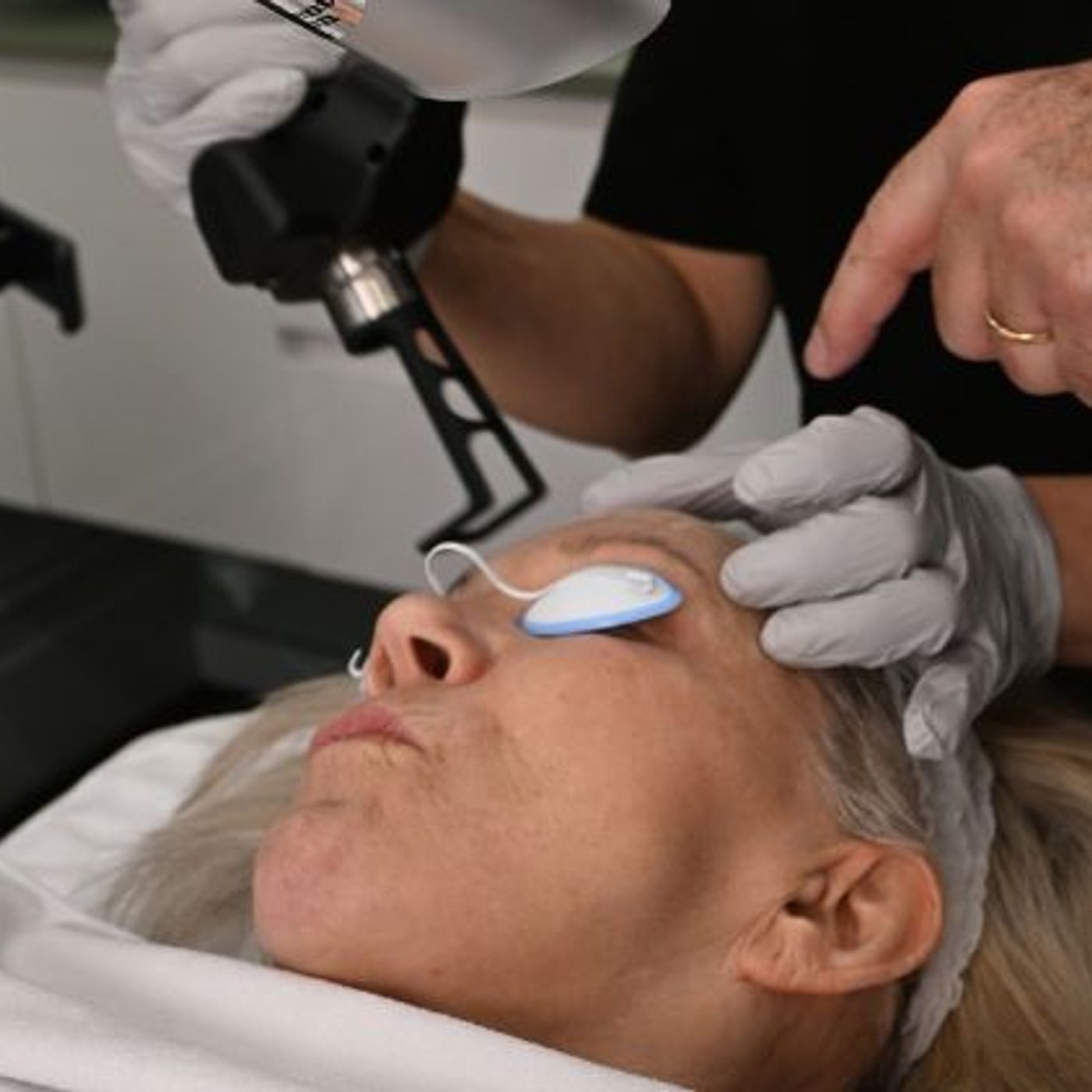 CO2 Laser for Scars Which Scars May Respond to Treatment episode artwork