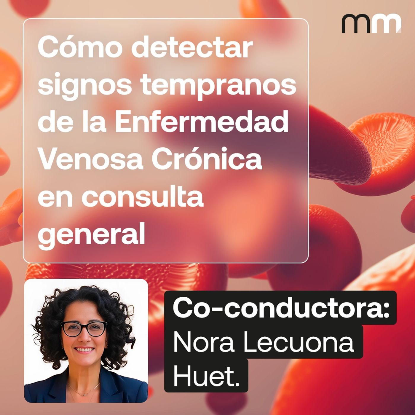 Como detectar signos tempranos de la Enfermedad Venosa Crónica en consulta general.
