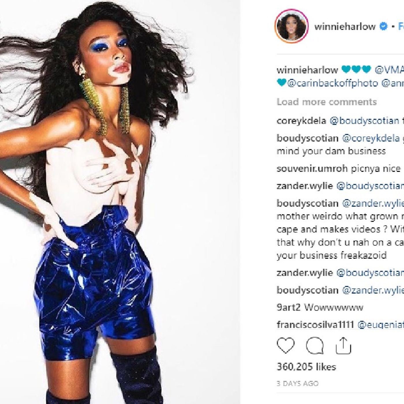 Winnie Harlow, Model With Vitiligo, Clap Back At Shady Comment. episode artwork