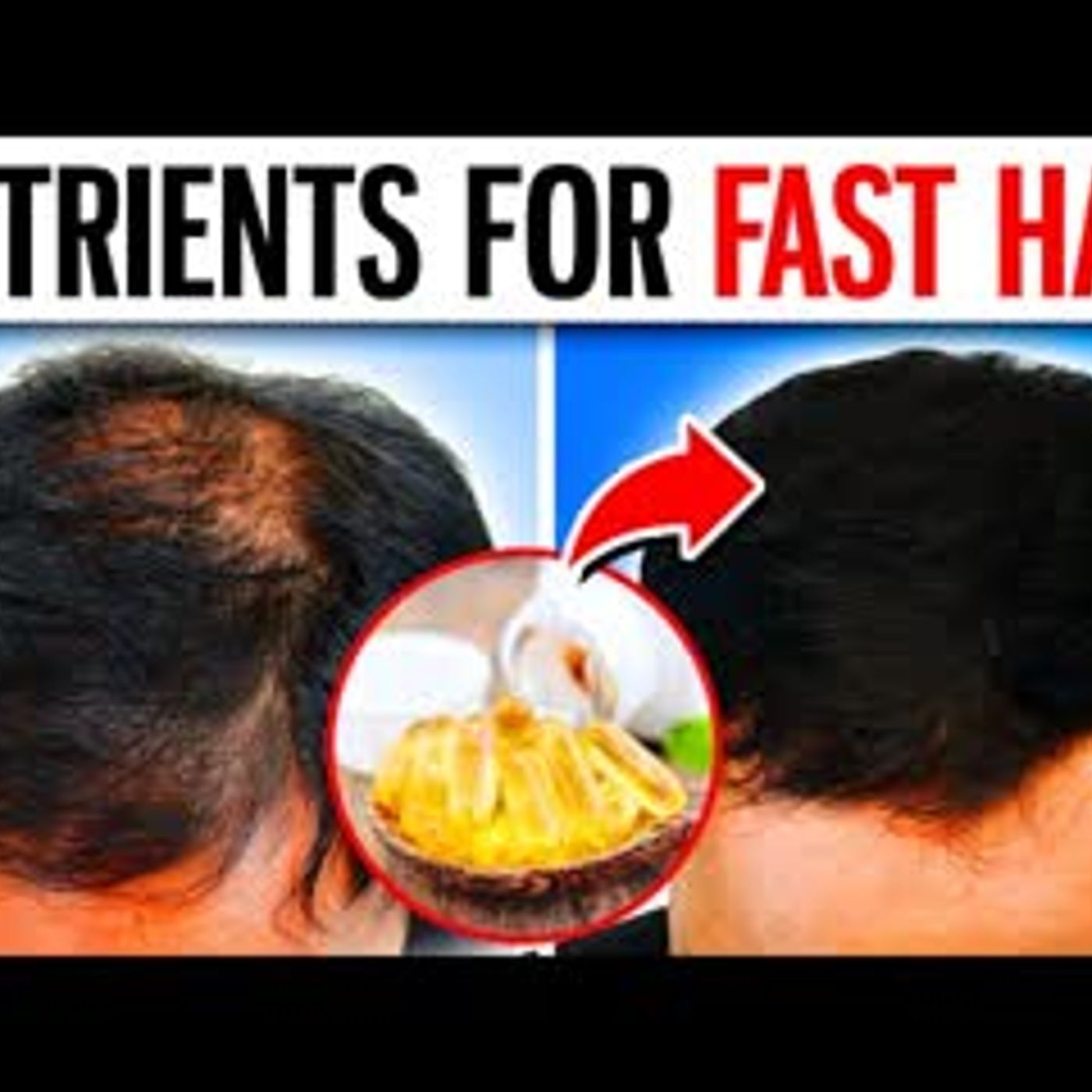 13 TOP Essential Nutrients For FASTER Hair Growth episode artwork