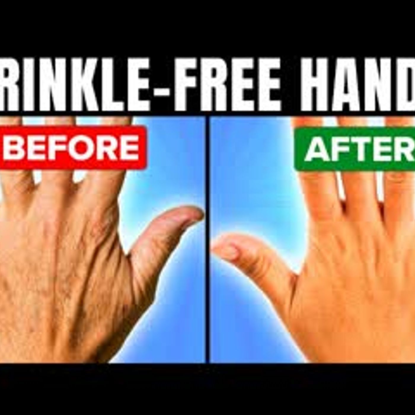 14 Best Home Remedies To Have Wrinkle-Free Hands episode artwork