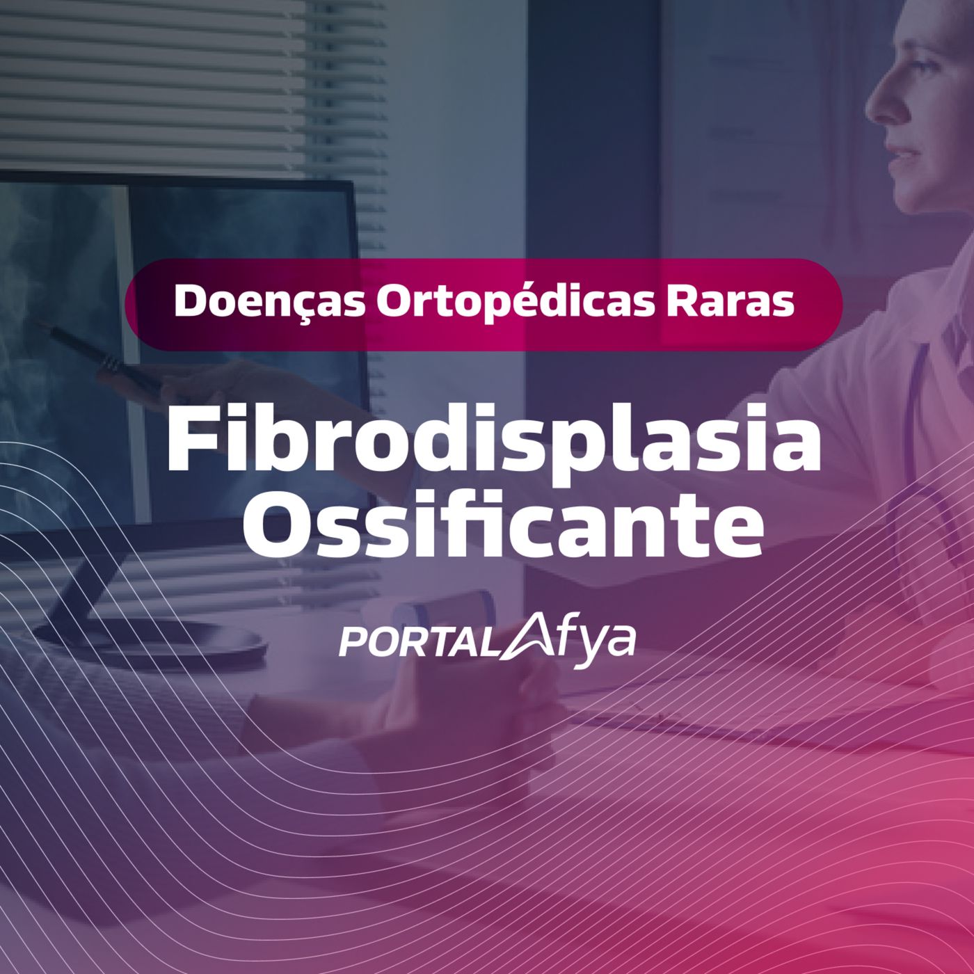 Podcast #142: Série Doenças Ortopédicas Raras: Fibrodisplasia Ossificante episode artwork