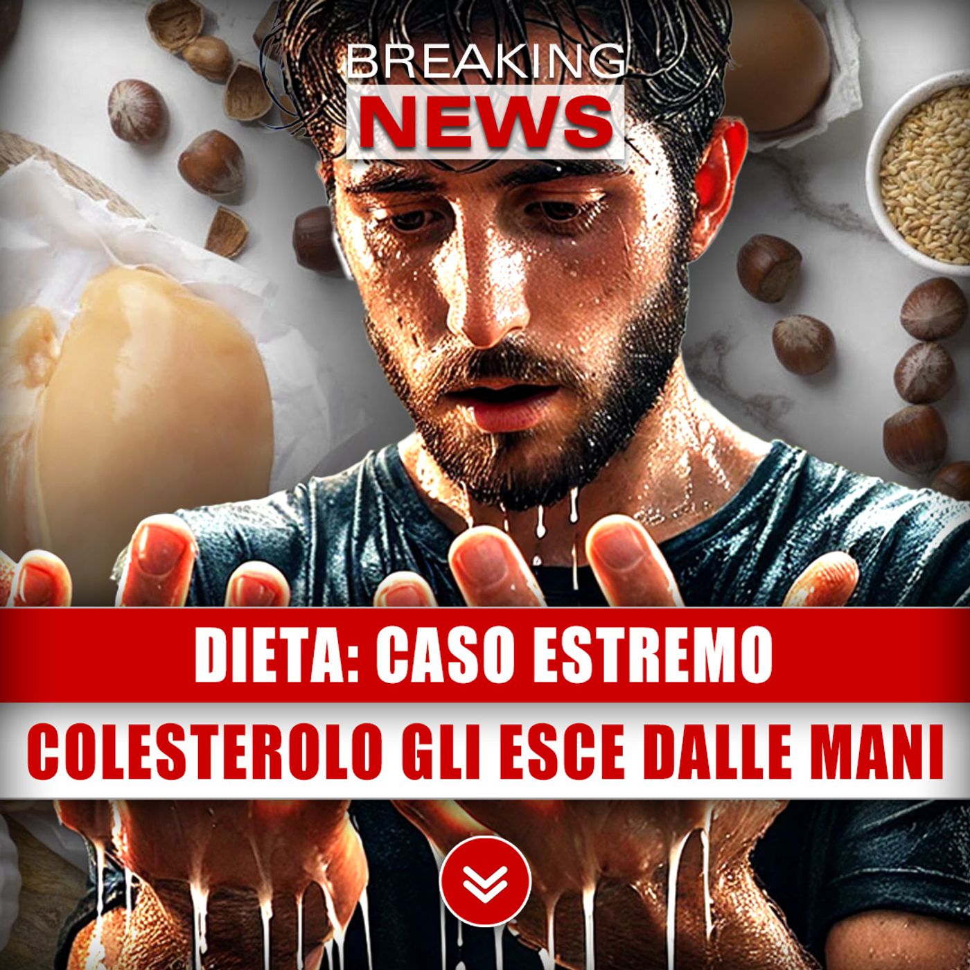Dieta, Caso Estremo: Colesterolo Gli Esce Dalle Mani!
