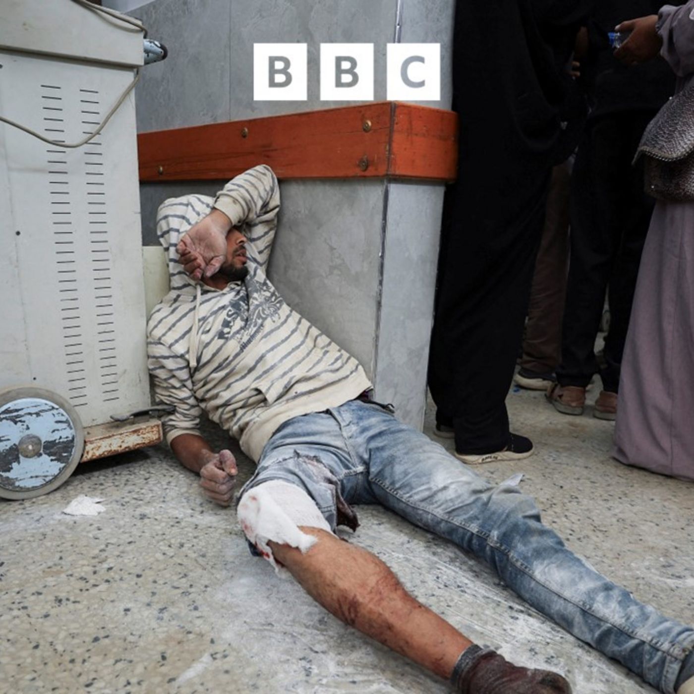 Patterns of injury in a Gaza war hospital