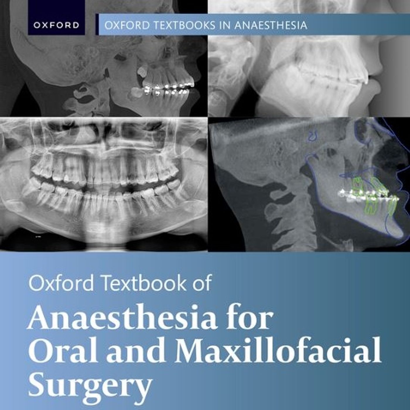 Oxford Textbook of Anaesthesia for Oral and Maxillofacial Surgery