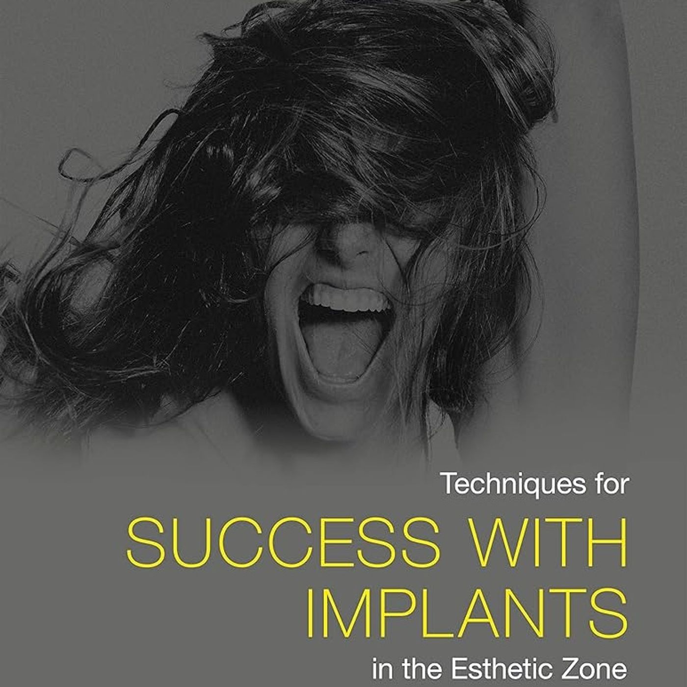 Techniques for Success With Implants in the Esthetic Zone