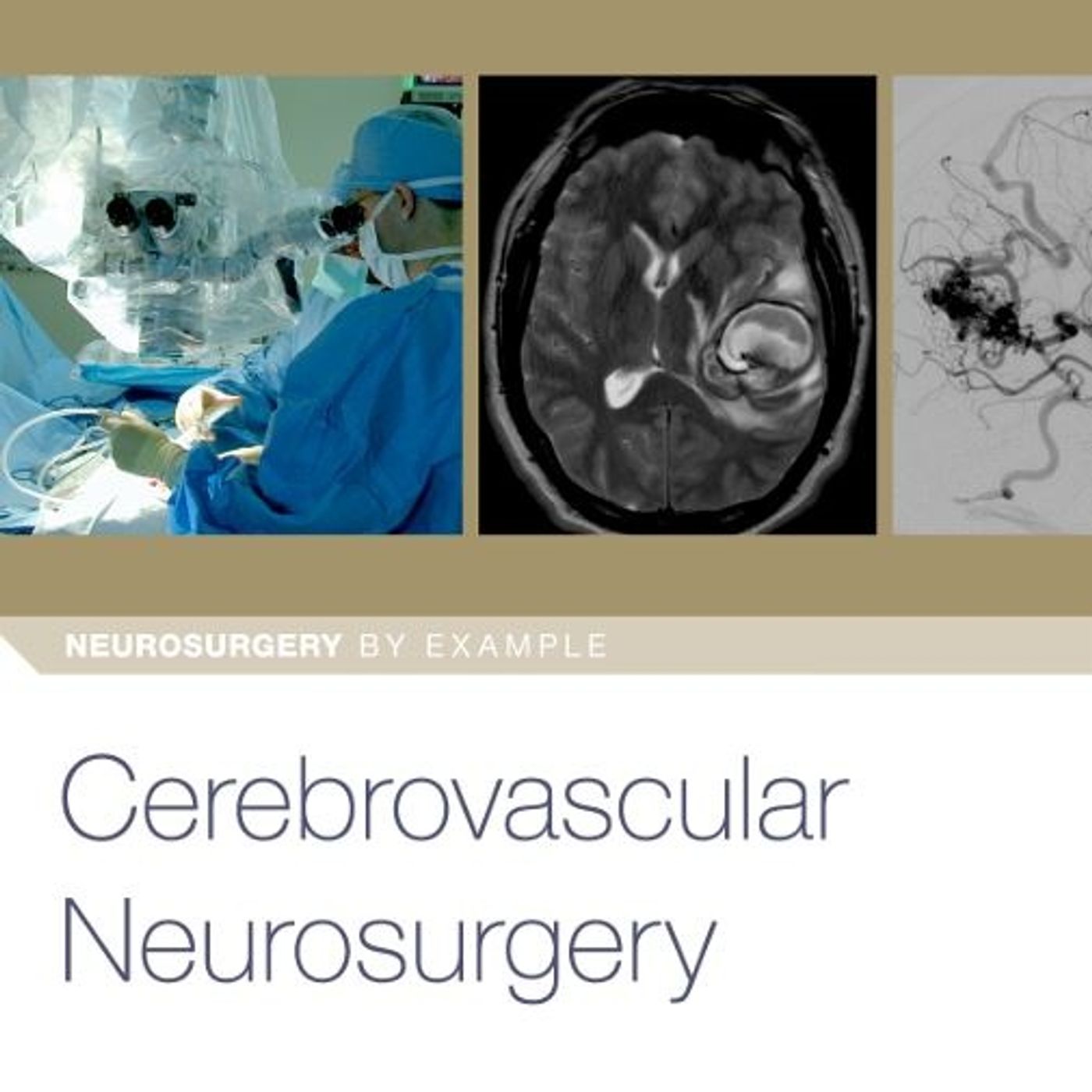 Cerebrovascular Neurosurgery