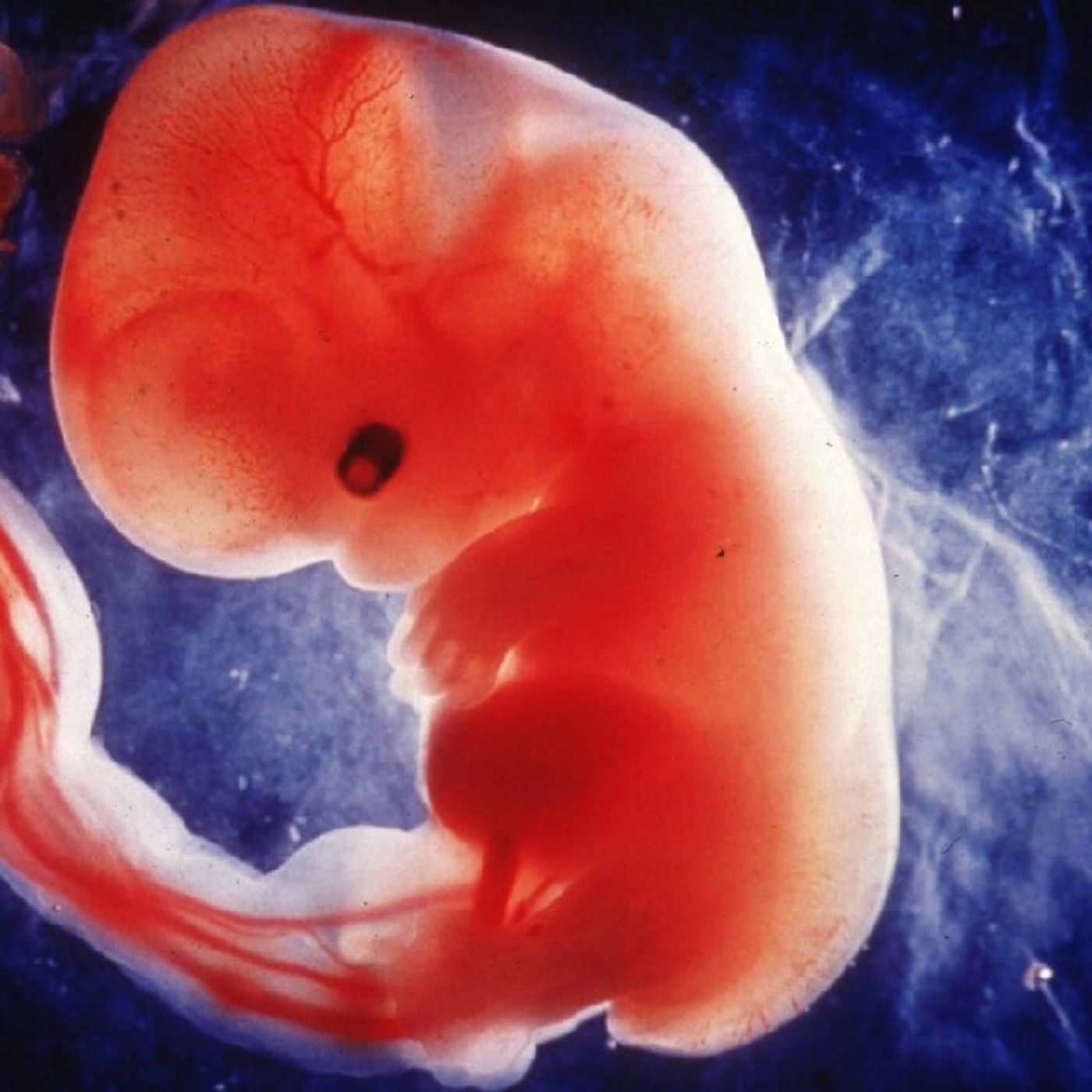 El show de VIVIR PARA CONTAR 1986