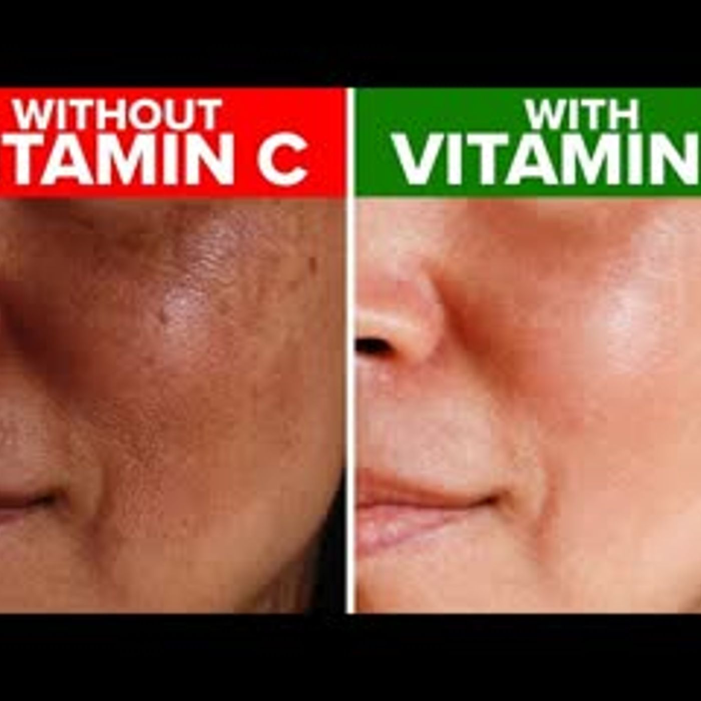 11 Reasons You Need To Use Vitamin C On Your Skin! episode artwork