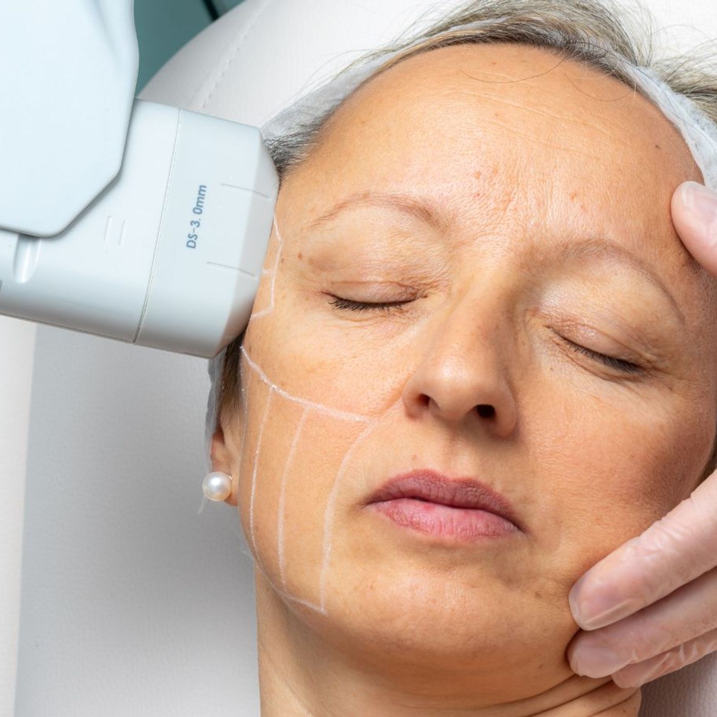Best Dermatologist-Approved Wrinkle Fixe
