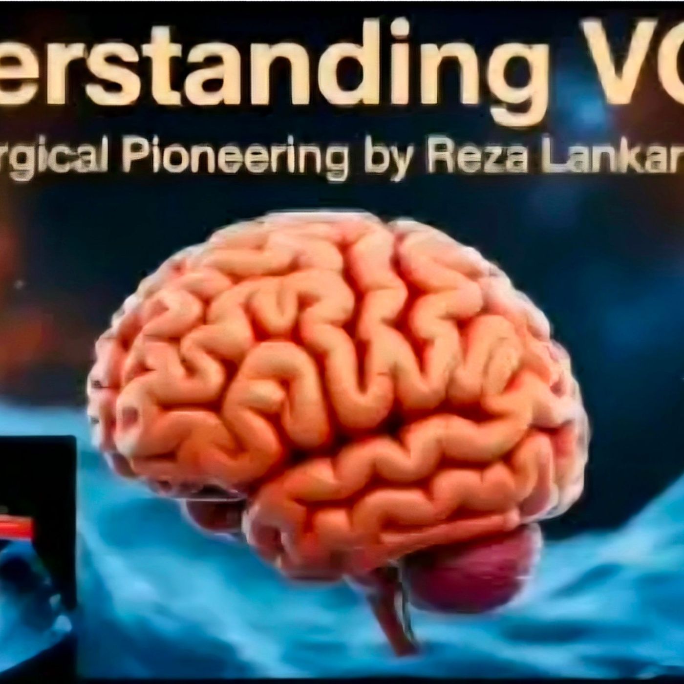 Understanding VOGM episode artwork