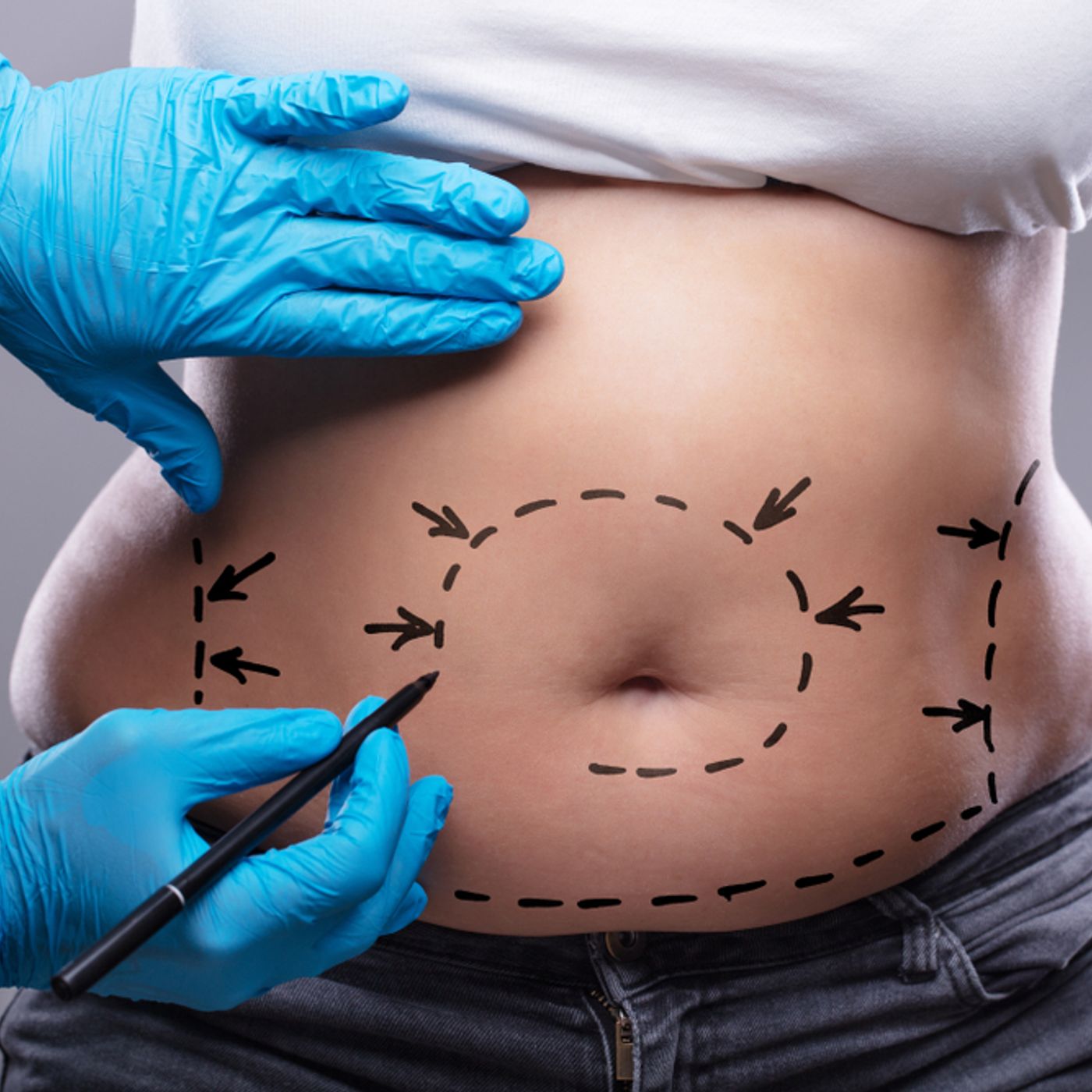 Obesità approccio chirurgico e nutrizionale episode artwork
