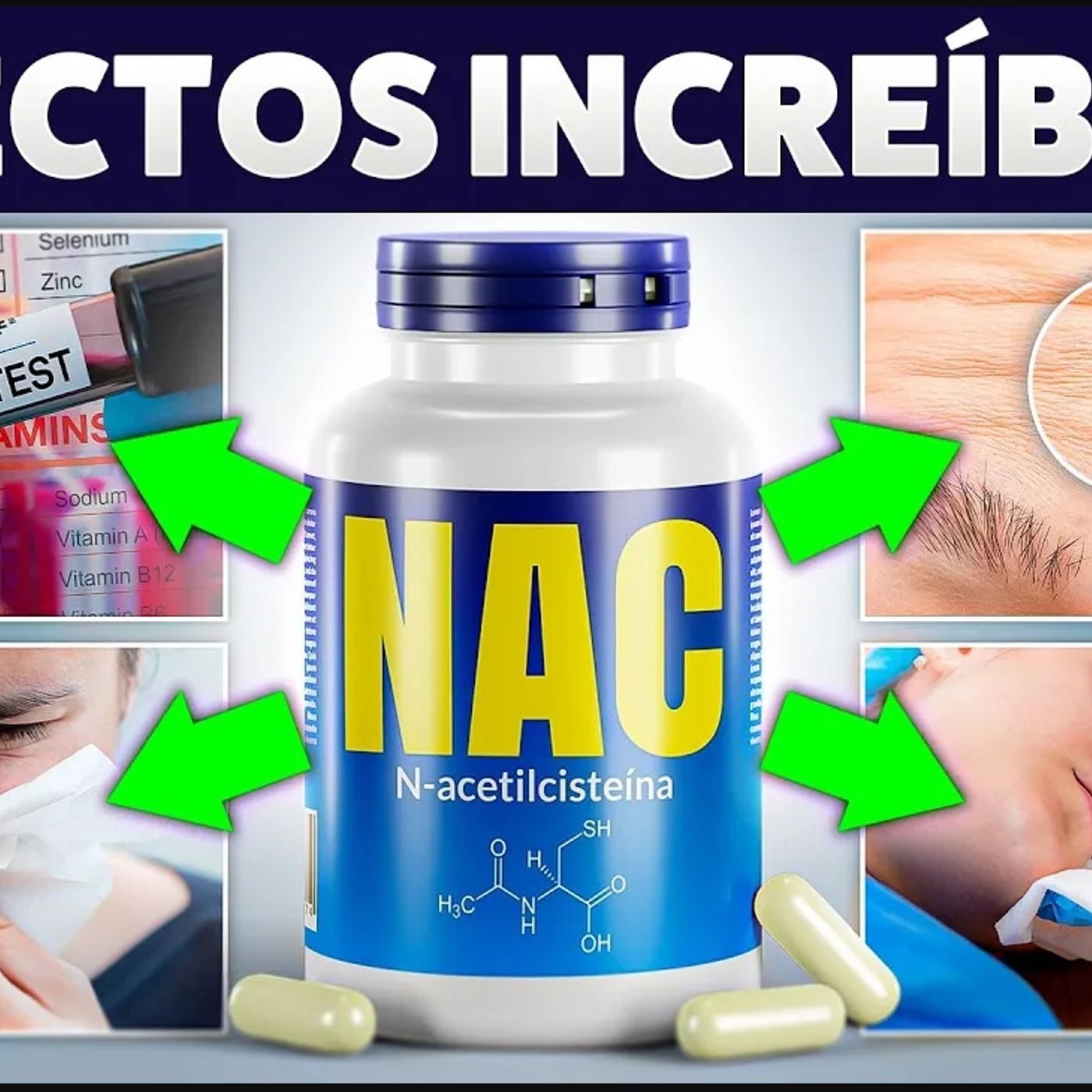 NAC: el SUPLEMENTO que podría SALVAR tu VIDA (+ Poderosos Beneficios ANTI-EDAD)