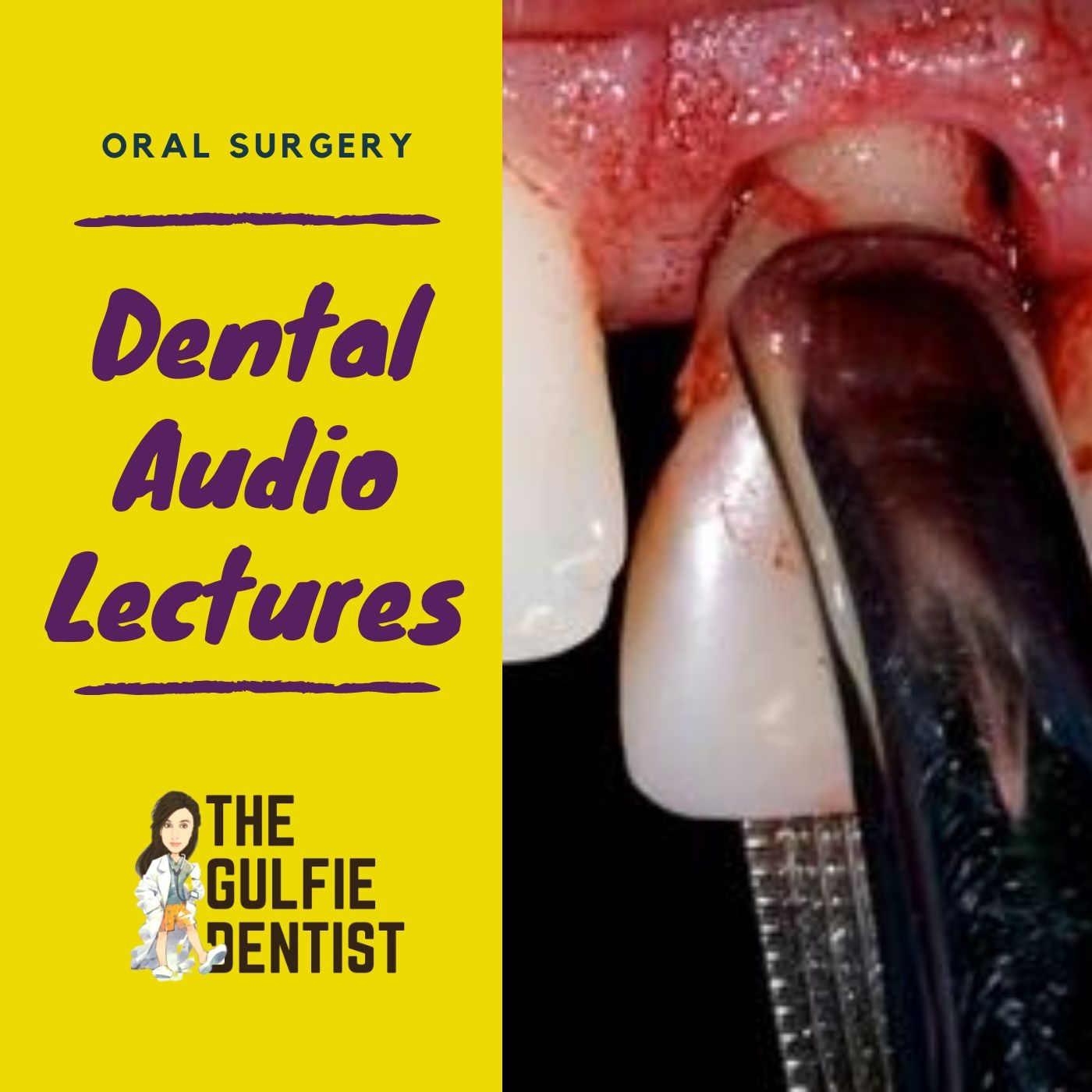 Oral Surgery