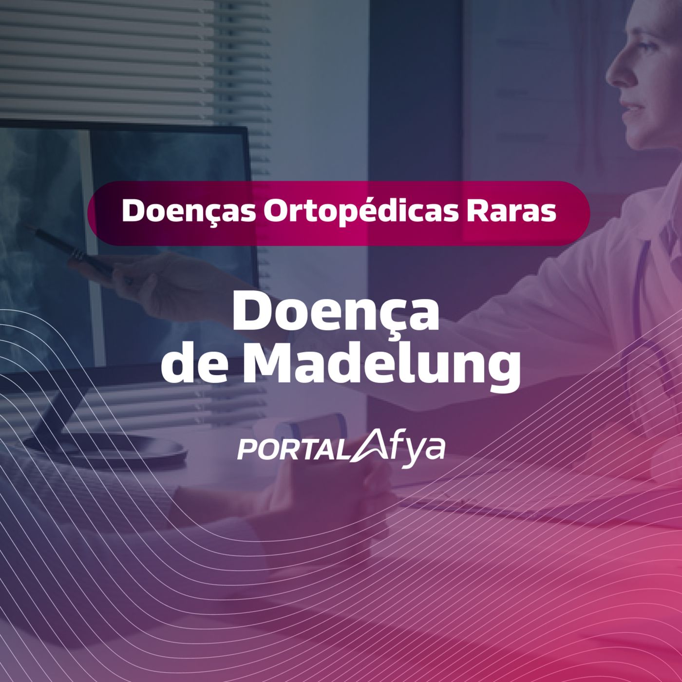 Podcast #155: Série Doenças Ortopédicas Raras: Doença de Madelung episode artwork