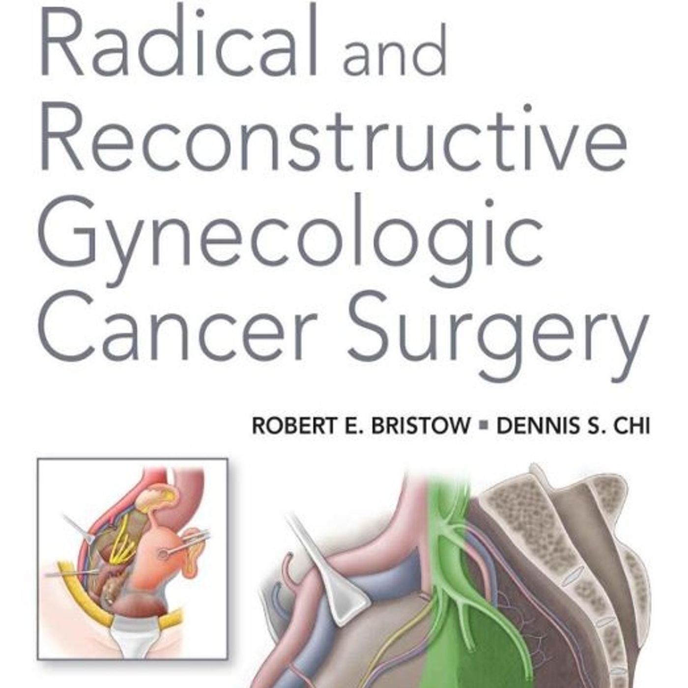 Radical and Reconstructive Gynecologic Cancer Surgery