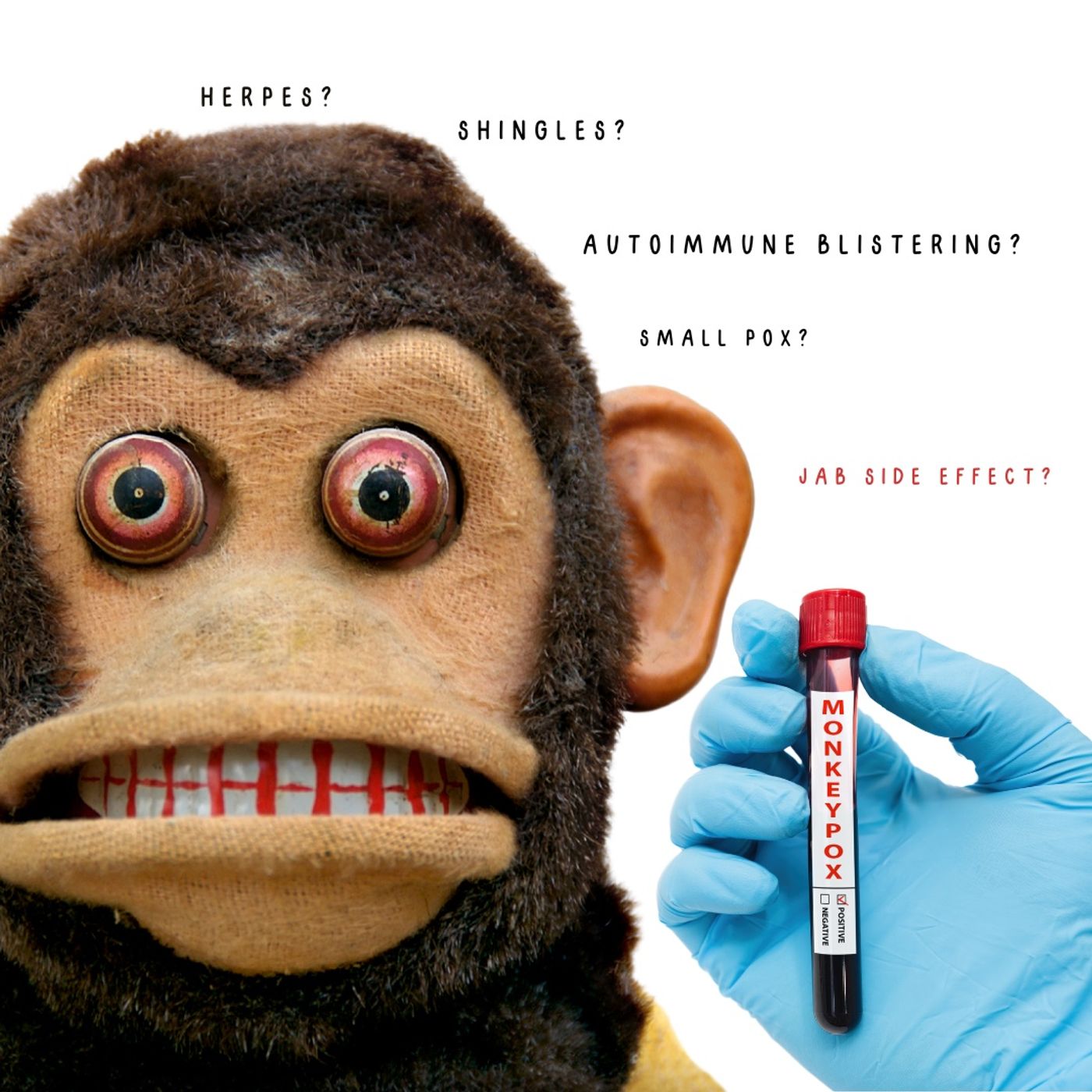 Episode 160- Don't Do It, Monkey Pox Vaccine episode artwork