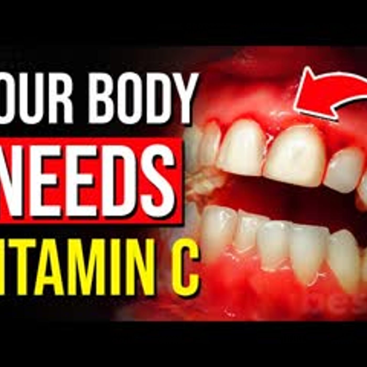 11 Things That Happens To Your Body When You Lack Vitamin C! episode artwork