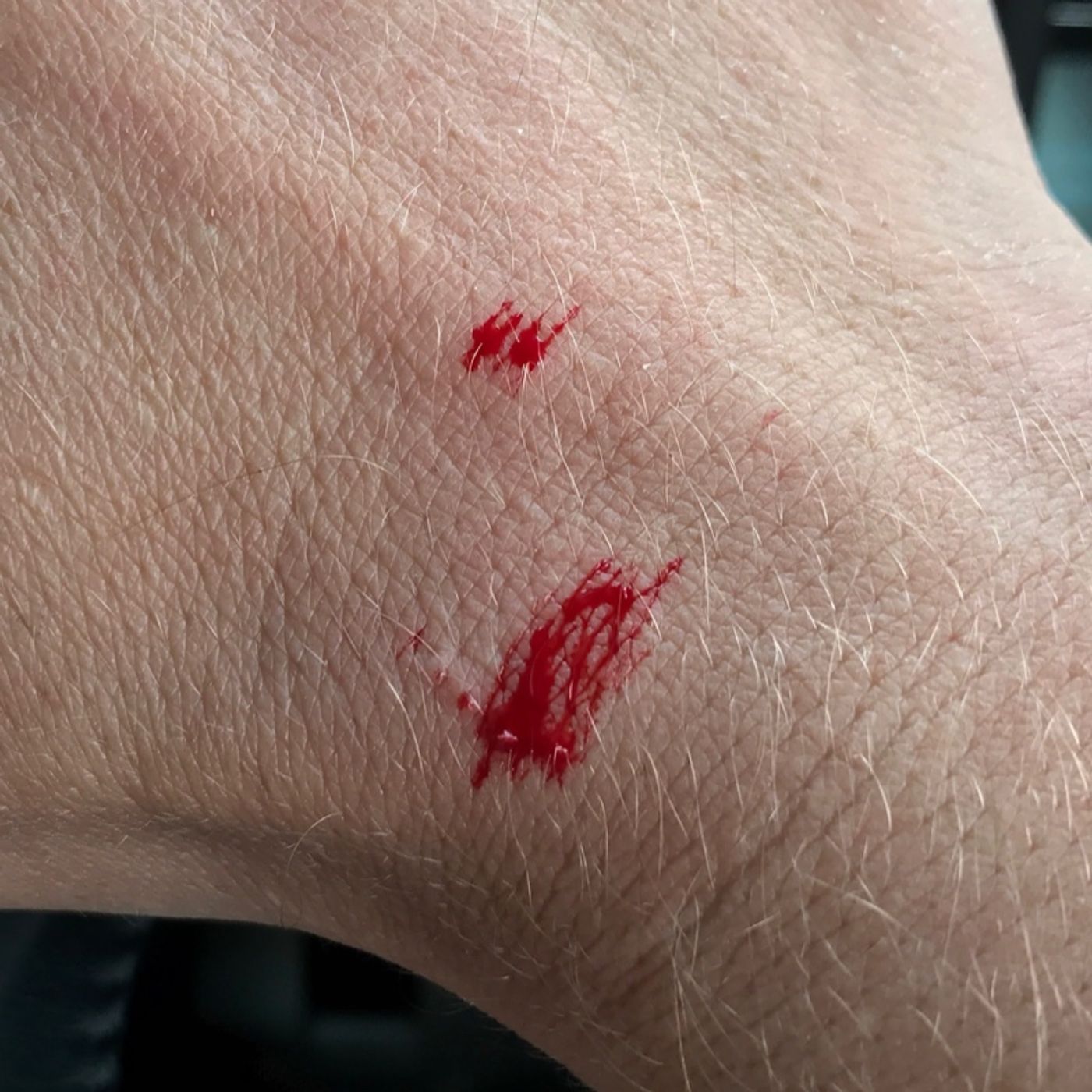 Don't do what you see on TV thumbnail