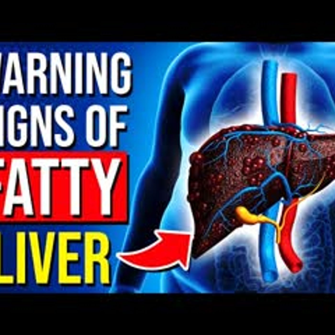 11 WARNING Signs Of Fatty Liver Nobody Ever Told You episode artwork