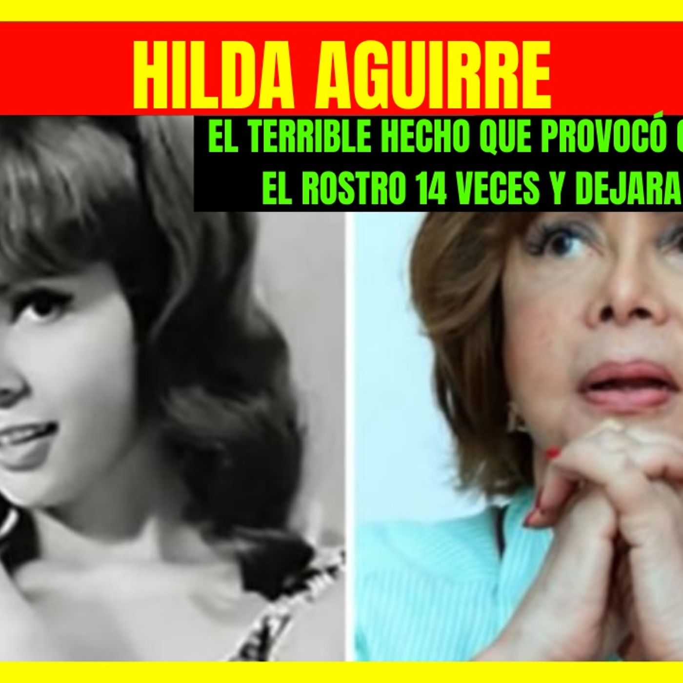 ⭐️El terrible hecho que provocó que HILDA AGUIRRE se operara el rostro en 14 ocasiones y dejara su carrera⭐️