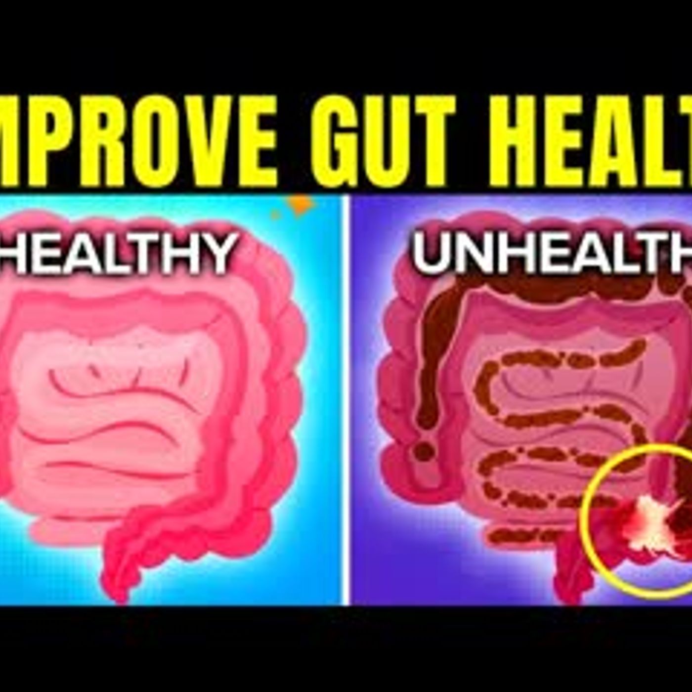 11 Healthy Ways To Improve Gut Health Naturally episode artwork