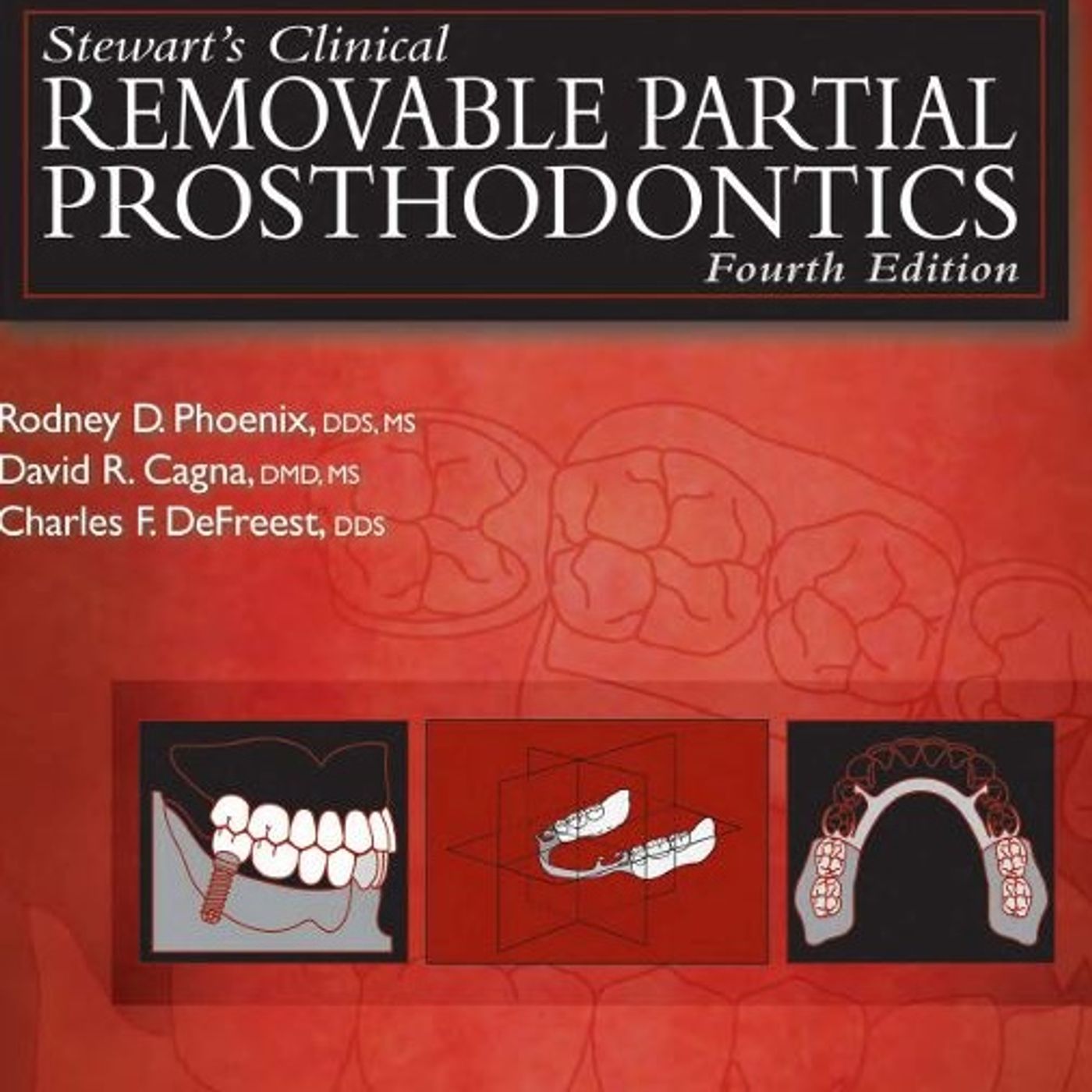 Stewart's Clinical Removable Partial Prosthodontics