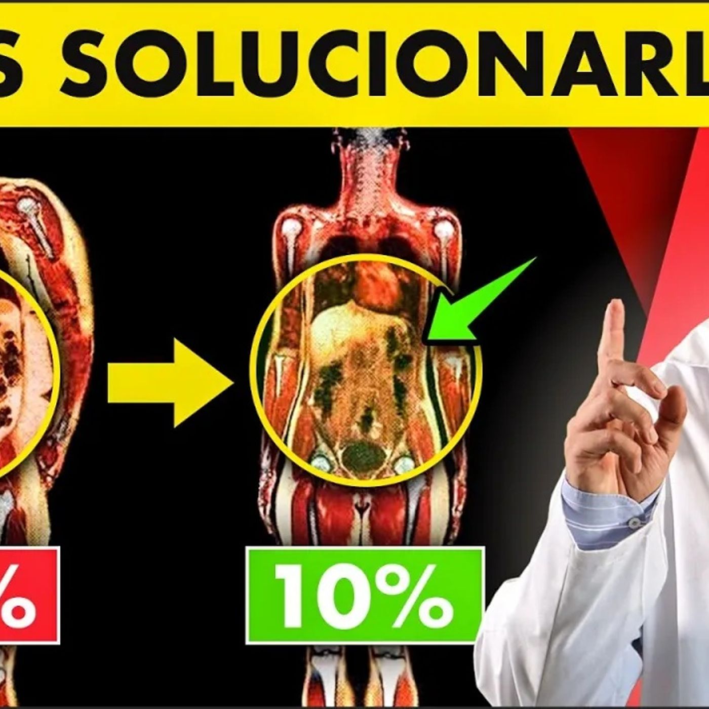 😲¡TIENES MUCHA GRASA VISCERAL! |🩺Cómo ELIMINARLA RÁPIDO con estos CAMBIOS COTIDIANOS