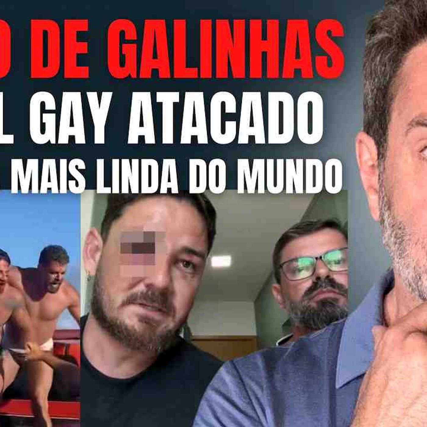 PORTO DE GALINHAS - CASAL GAY É AGREDIDO POR DONOS DA PRAIA - TENTATIVA DE HOMICÍDIO_ HOMOFOBIA