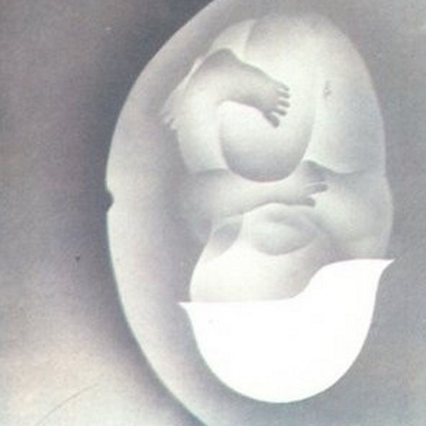 Война episode artwork
