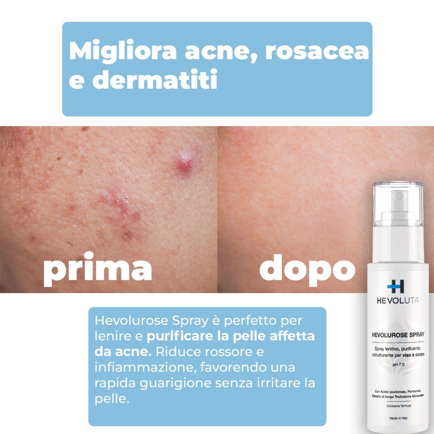 Skincare con Hevoluta