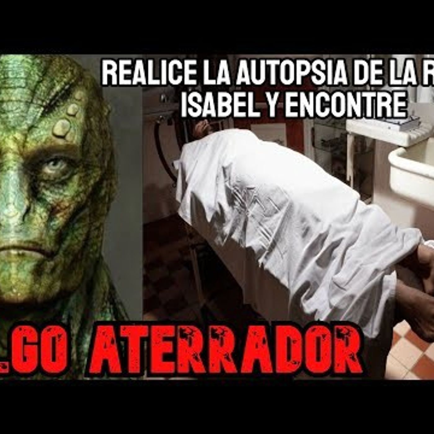 Me Pidieron Examinar Cuerpo De Isabel II Antes De Su Funeral, Encontre Algo Impo episode artwork