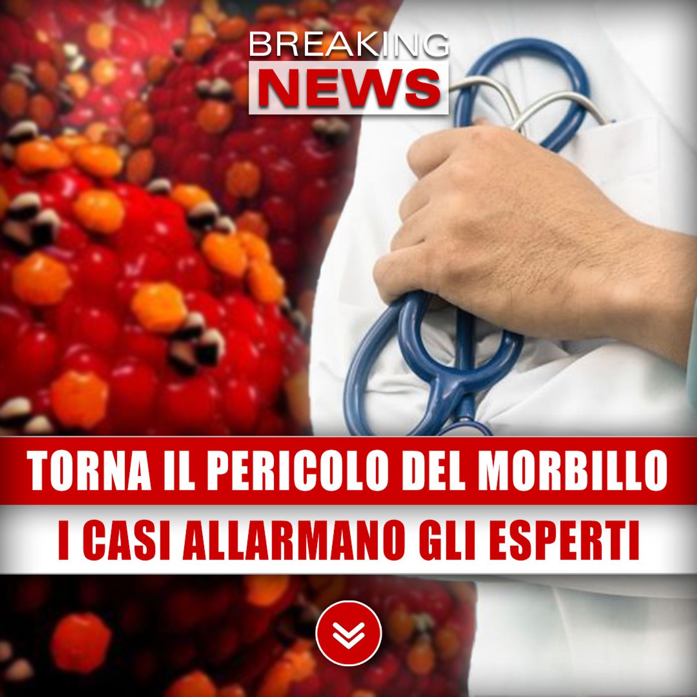 Torna Il Pericolo Del Morbillo: I Casi Registrati Allarmano Gli Esperti!