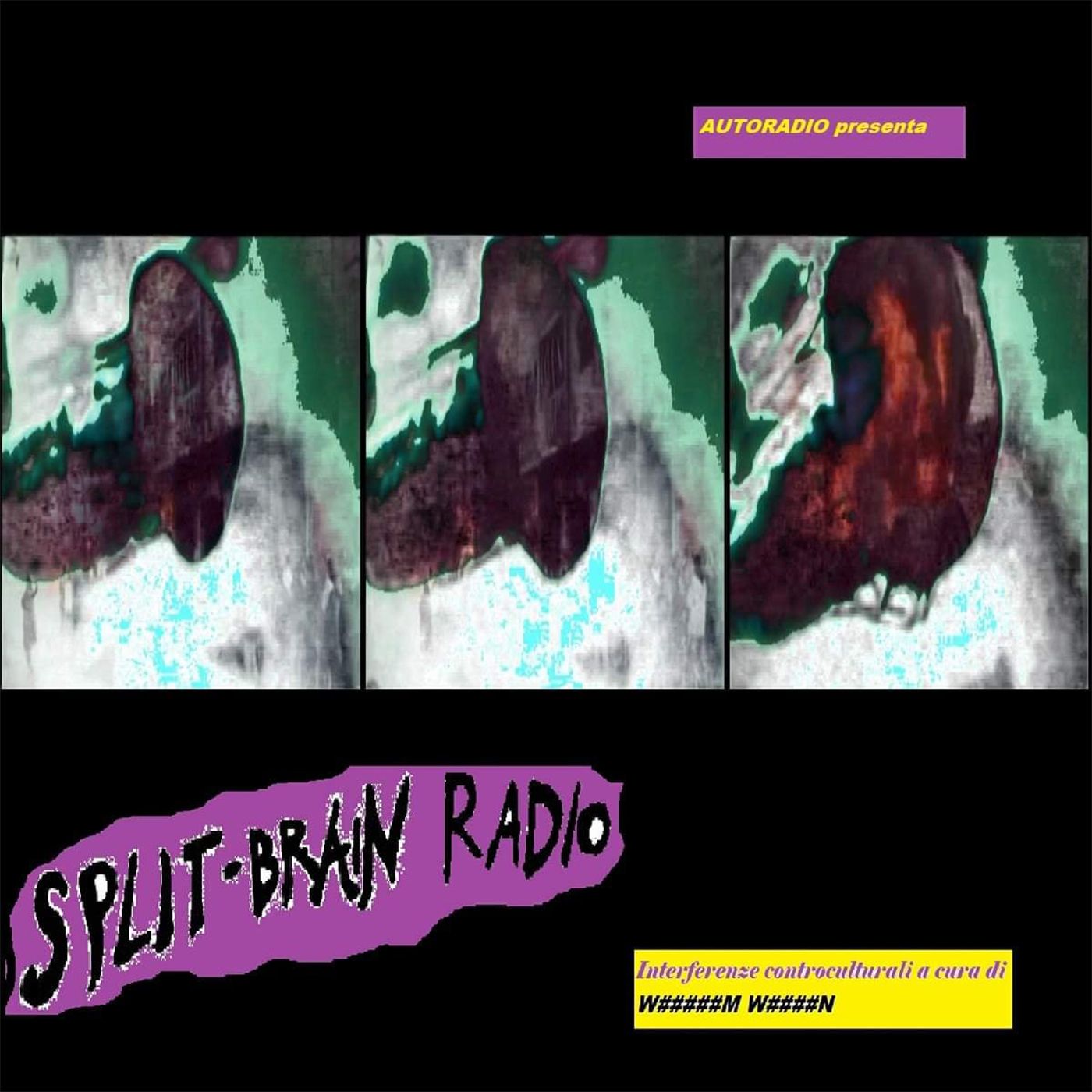 Spit Brain Radio