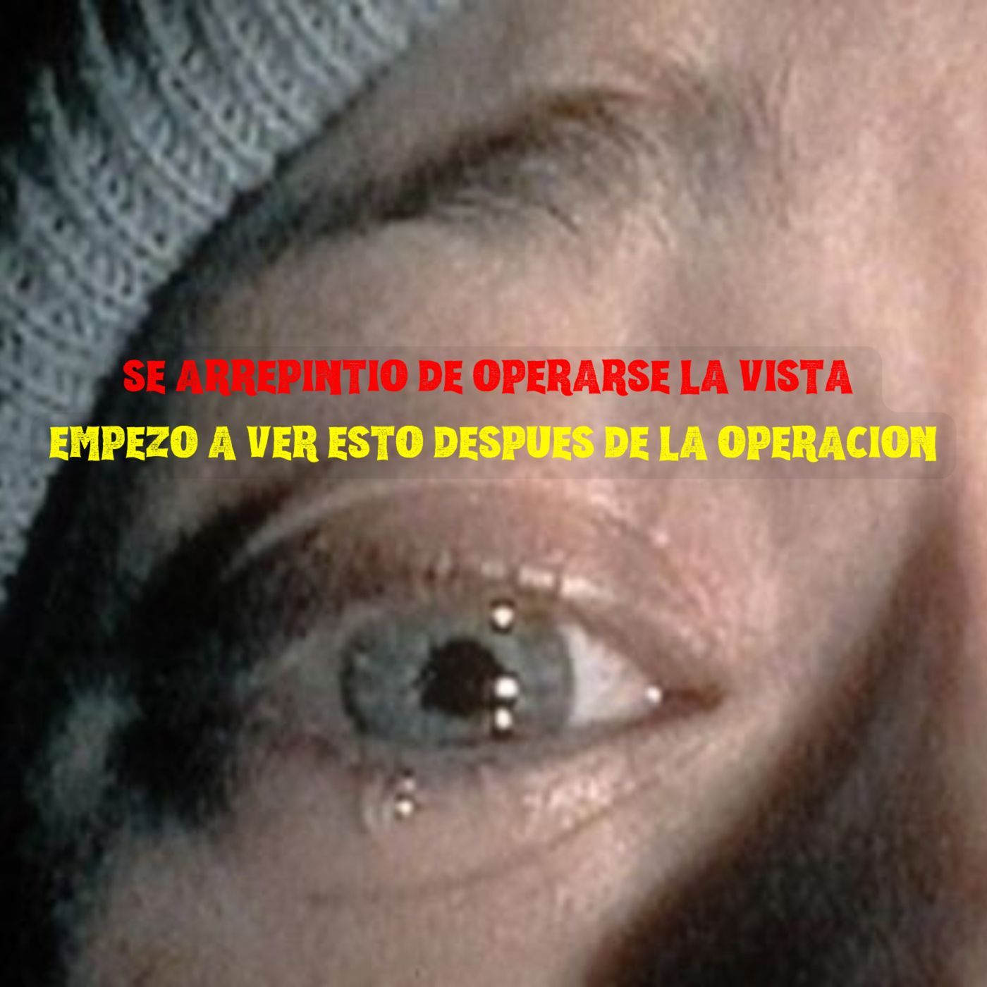 MIS NUEVOS OJOS