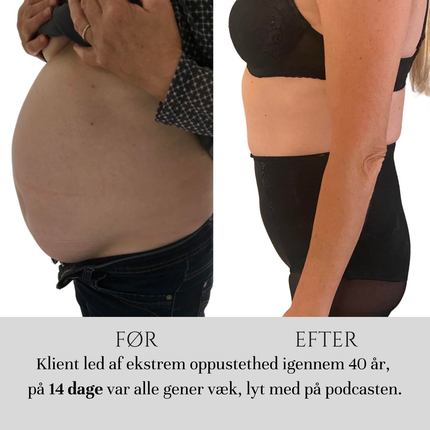 Farvel til 40 års oppustethed på 14 dage episode artwork