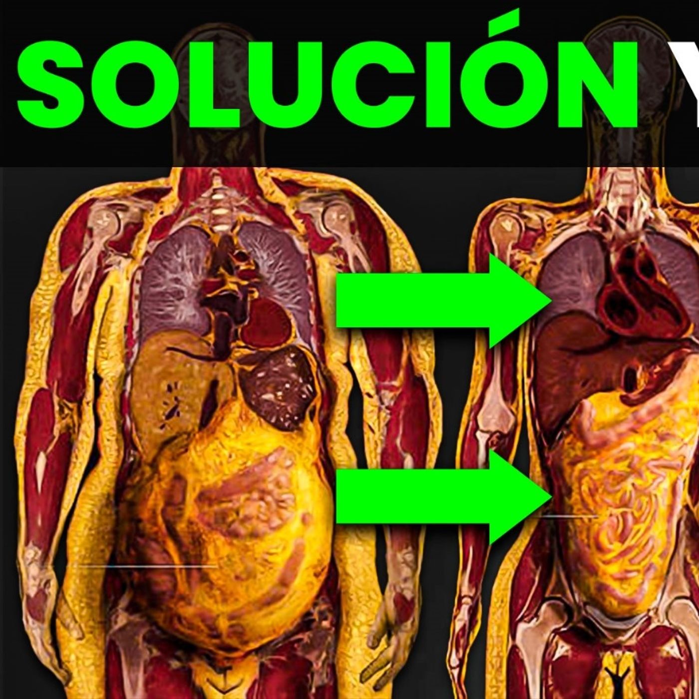 Reduce AL MÁXIMO tu GRASA VISCERAL: hazlo ASÍ