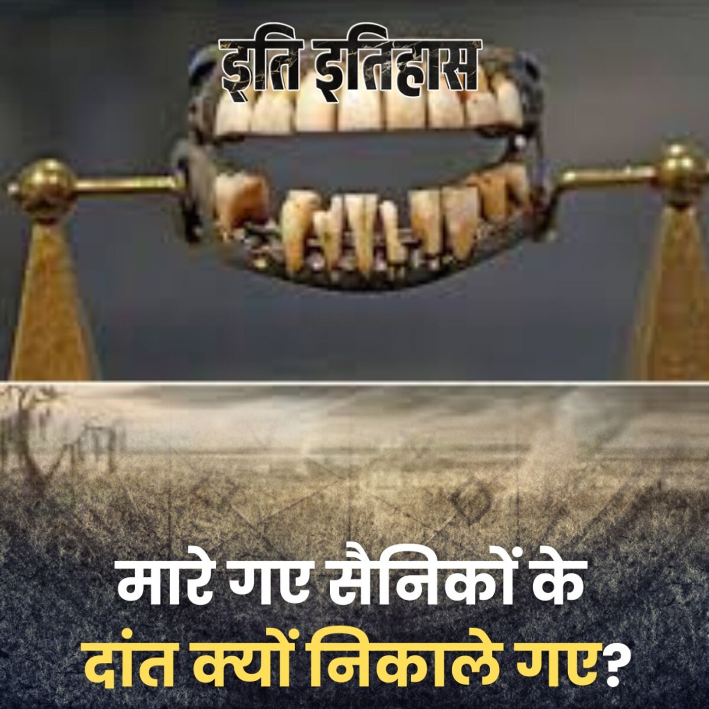 वाटरलू की जंग में मृत सैनिकों के दांत क्यों निकाल लिए गए?: इति इतिहास, Ep 160
