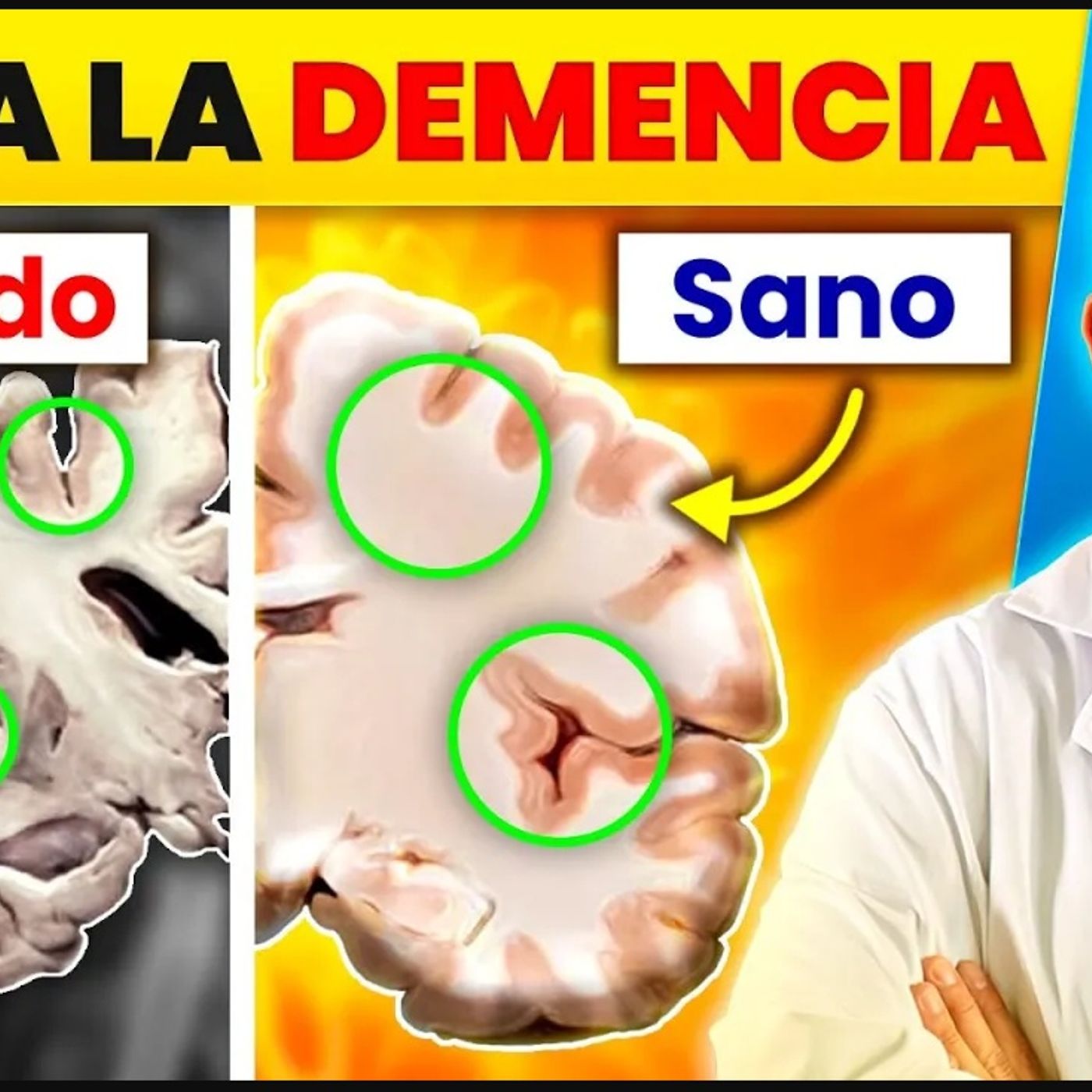 OPTIMIZA tu CEREBRO: 7 herramientas científicas para REJUVENECER tu MATERIA GRIS