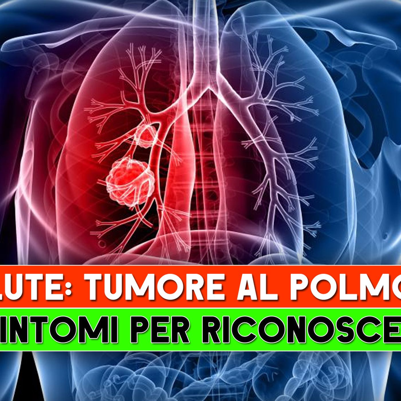 Tumore Al Polmone: Ecco I 5 Sintomi Per Riconoscerlo! episode artwork