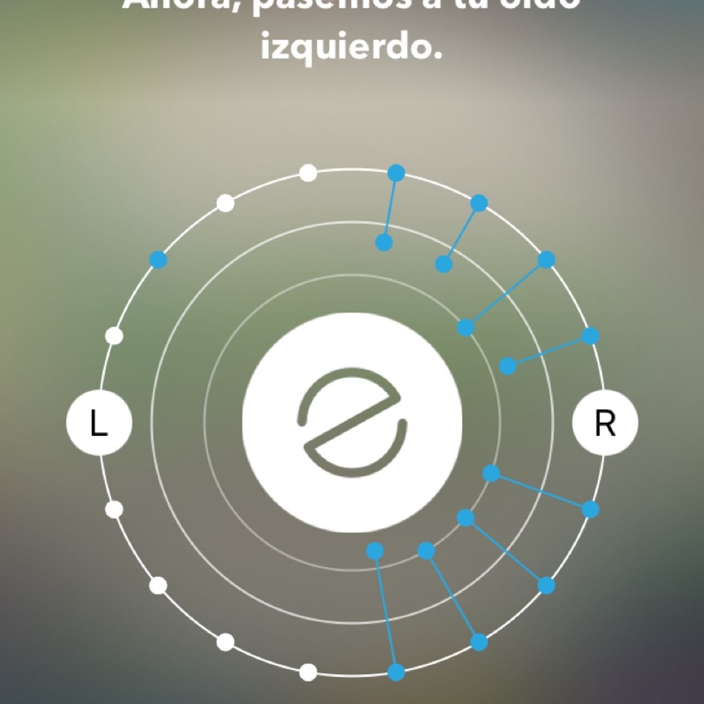 Napster y su audiometría