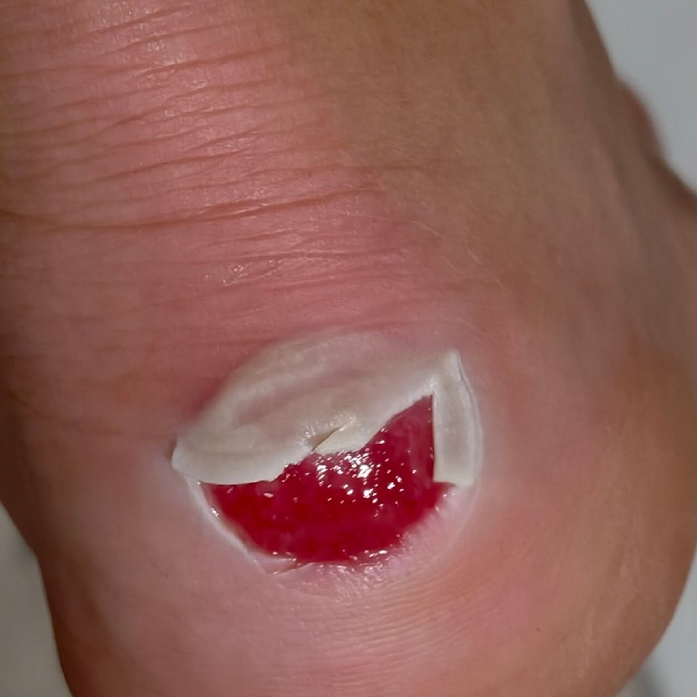 Que me comprado unas Crocs